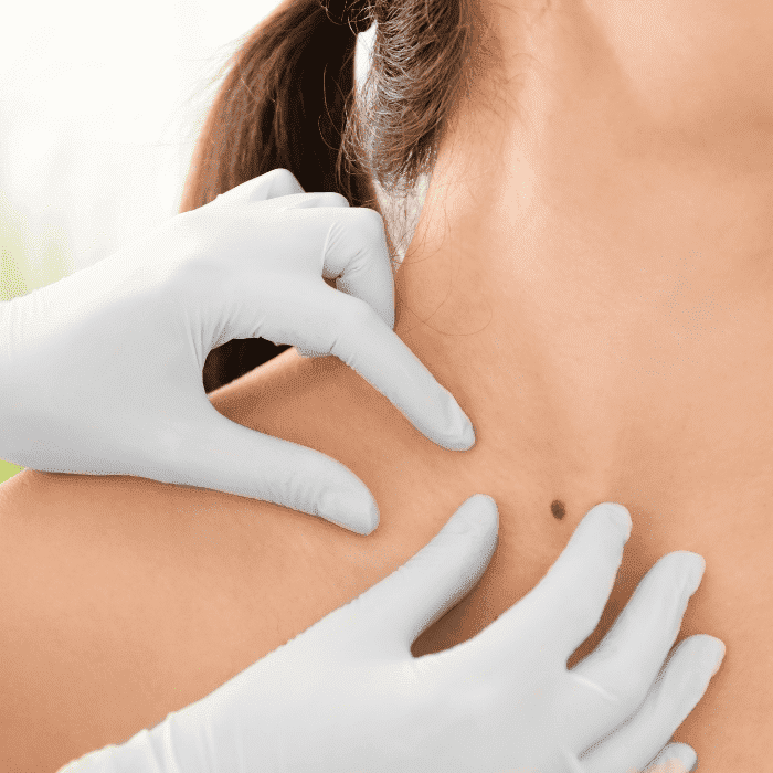 cirujano-oncologo-de-cabeza-y-cuello